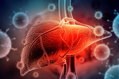Siaga Hepatitis Misterius, Inilah Daftar 7 Provinsi dengan Jumlah Kasus Hepatitis Tertinggi di Indonesia