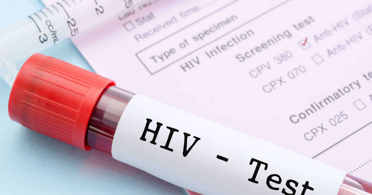 Waspada, Kasus HIV AIDS Melonjak Naik pada Pertengahan 2022