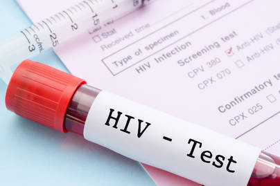 Waspada, Kasus HIV AIDS Melonjak Naik pada Pertengahan 2022