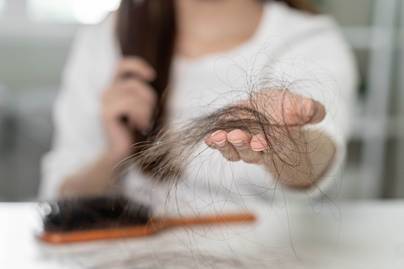 Survei: Sebagian Besar Orang Indonesia Alami Permasalahan Rambut Rontok