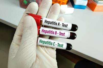 Keadaan Hepatitis di Indonesia, Sebagian Besar Bayi Tertular Melalui Ibunya yang Positif