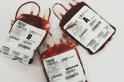 Membongkar Data Prevalensi Anemia di Indonesia: Lebih dari Sekadar Kurang Zat Besi