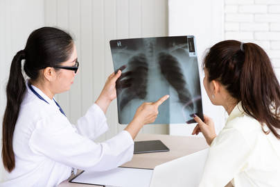 10 Provinsi Paling Tanggap Deteksi Kasus TB 2025 Berdasarkan Cakupan Penemuan Kasus